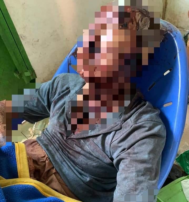 Pria Tua Renta di Rohil Tewas Menggenaskan Duduk di Kursi Plastik