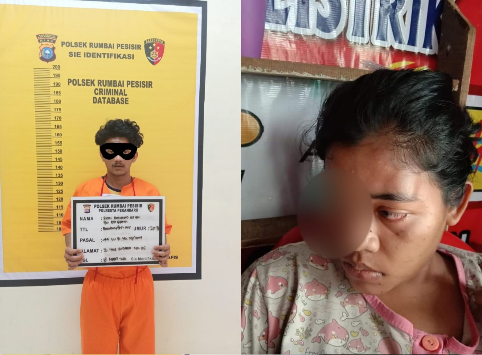 Suami Pengangguran di Pekanbaru Ini Tendang Mata Istrinya Sampai Lebam
