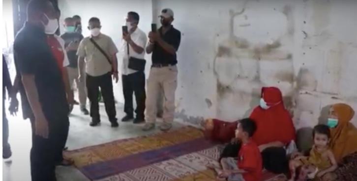 Bocah Kakak-Adik di Medan Derita Penyakit Kulit Aneh, Sekujur Tubuh Penuh Luka, Gubernur Cek Langsung