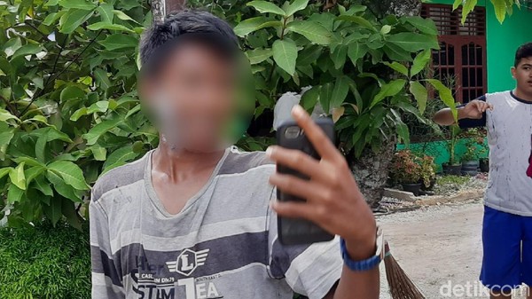Wajah & Leher Melepuh, Bocah 12 Tahun di Pekanbaru Disiram Air Panas Oleh Pengurus Masjid