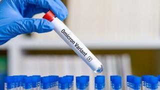 6 Hal yang Perlu Diketahui Tentang Varian COVID-19 Omicron