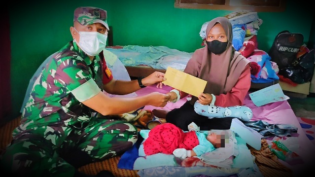 Kasihan, Bayi Perempuan di Riau Lahir Tanpa Batok Kepala