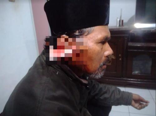 Muadzin di Sukabumi Dibacok Telinganya Oleh OTK  Saat Salat Subuh