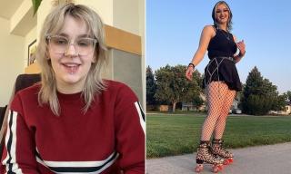 Aneh! Alergi Seks, Mahasiswi Cantik Ini Kesakitan jika Terkena Sperma