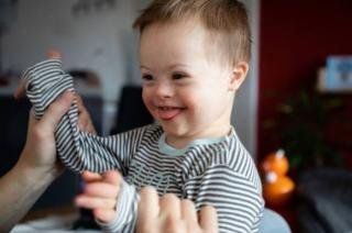 Ciri-ciri Down Syndrome pada Bayi yang Dapat Dikenali Secara Fisik