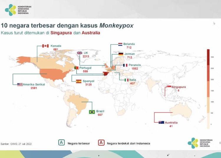 Kasus Cacar Monyet Belum Ditemukan di Indonesia