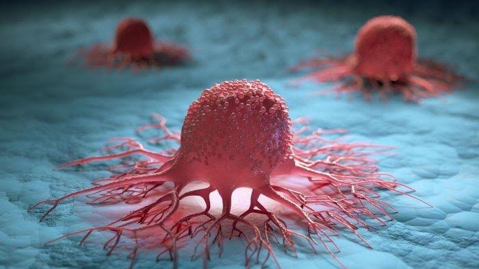 Kemenkes Siapkan Empat Pilar Strategi Penanganan Kanker