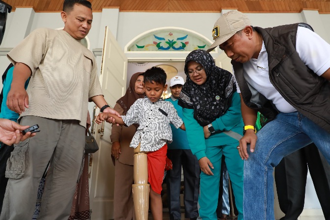 Afni Tepati Janji, Yuda Anak Disabilitas itu Kini Punya Kaki Palsu