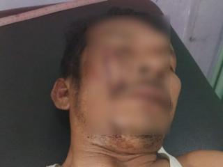 Polisi dan Wartawan Diserang Kelompok Preman Saat Penertiban PETI di Kuansing