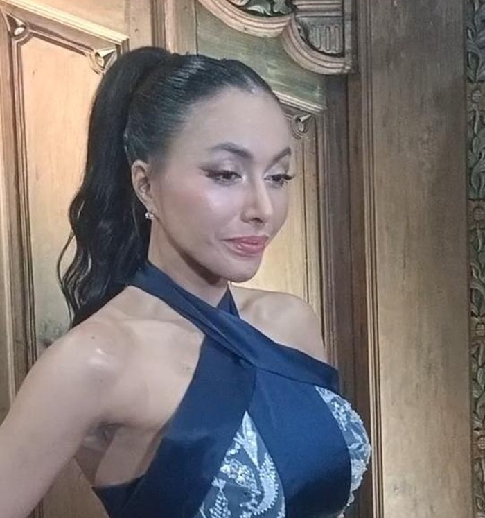 Ini Alasan Denada Jalani Operasi Payudara di Usia 47 Tahun